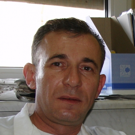 Ракът на пикочния мехур идва без болка