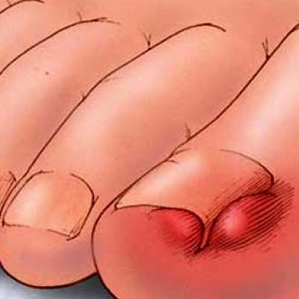 Д-р Гриша Матеев: Гъбичките обичат топло и влажно 