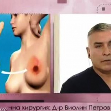 Реконструкция на гърдата при жени с онкологични заболявания